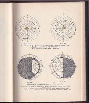 Jan Deyl: Zevní choroby oční
