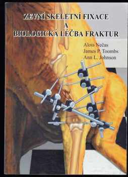 Alois Nečas: Zevní skeletní fixace a biologická léčba fraktur
