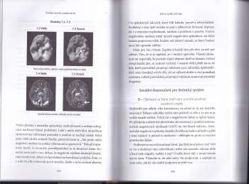 Daniel G Amen: Změňte mozek, změňte život